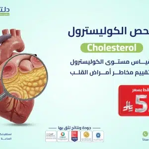 فحص الكوليسترول