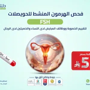 فحص الهرمون المنشط للحويصلات