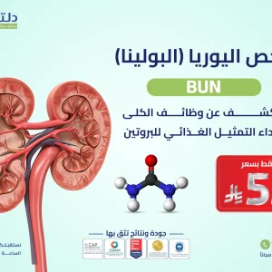 فحص اليوريا