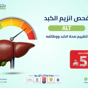 فحص ALT لصحة الكبد