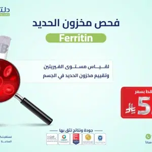 فحص مخزون الحديد